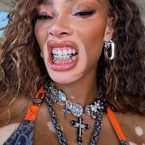 winnieharlow